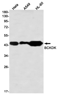 BCKDK Rabbit mAb ABZ3263