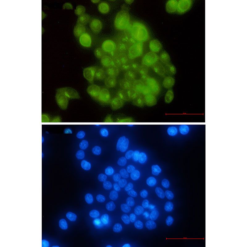 BubR1 Rabbit mAb ABZ3264