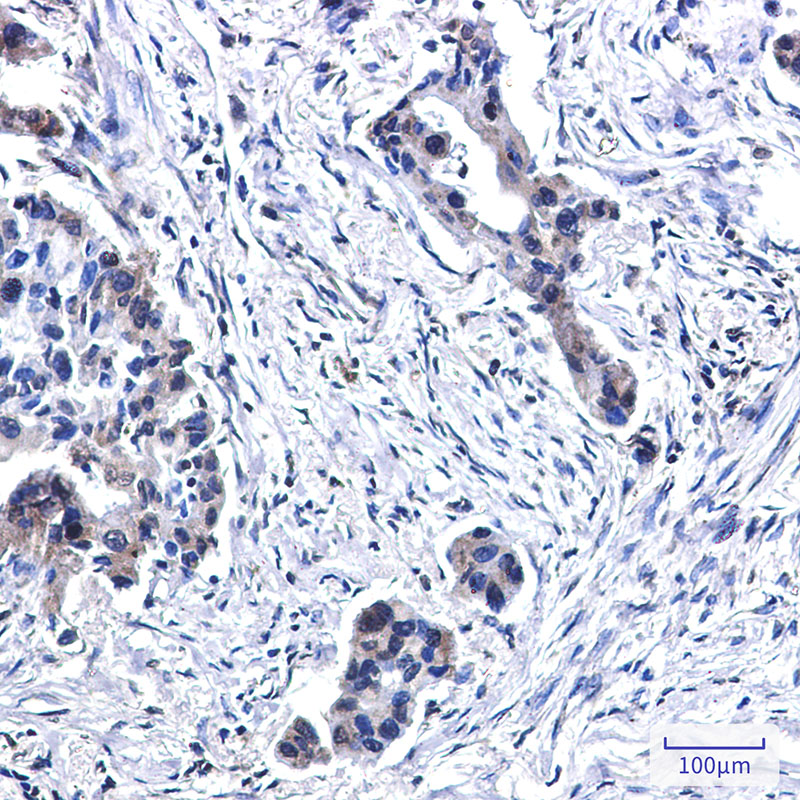 BubR1 Rabbit mAb ABZ3265