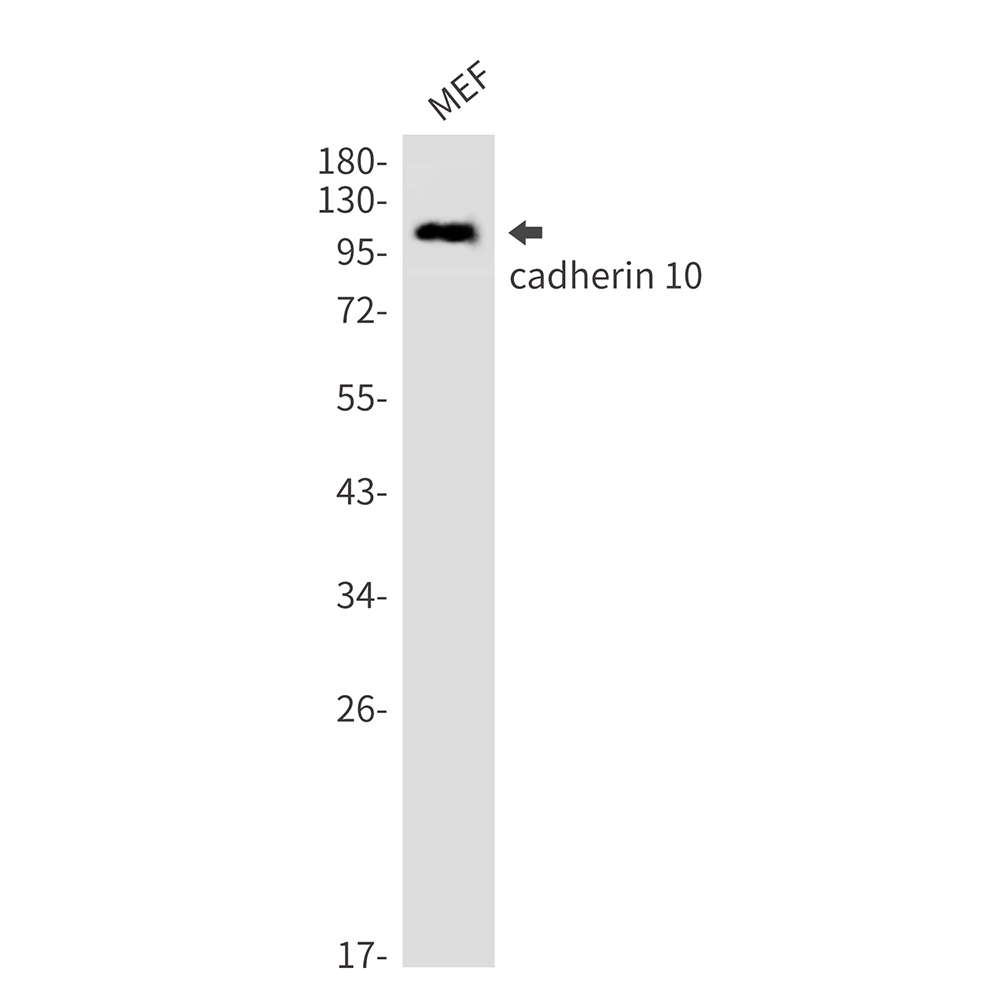 Cadherin 10 Rabbit mAb ABZ3266