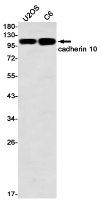 Cadherin 10 Rabbit mAb ABZ3266