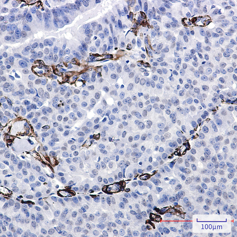 Caldesmon/CDM Rabbit mAb ABZ3267