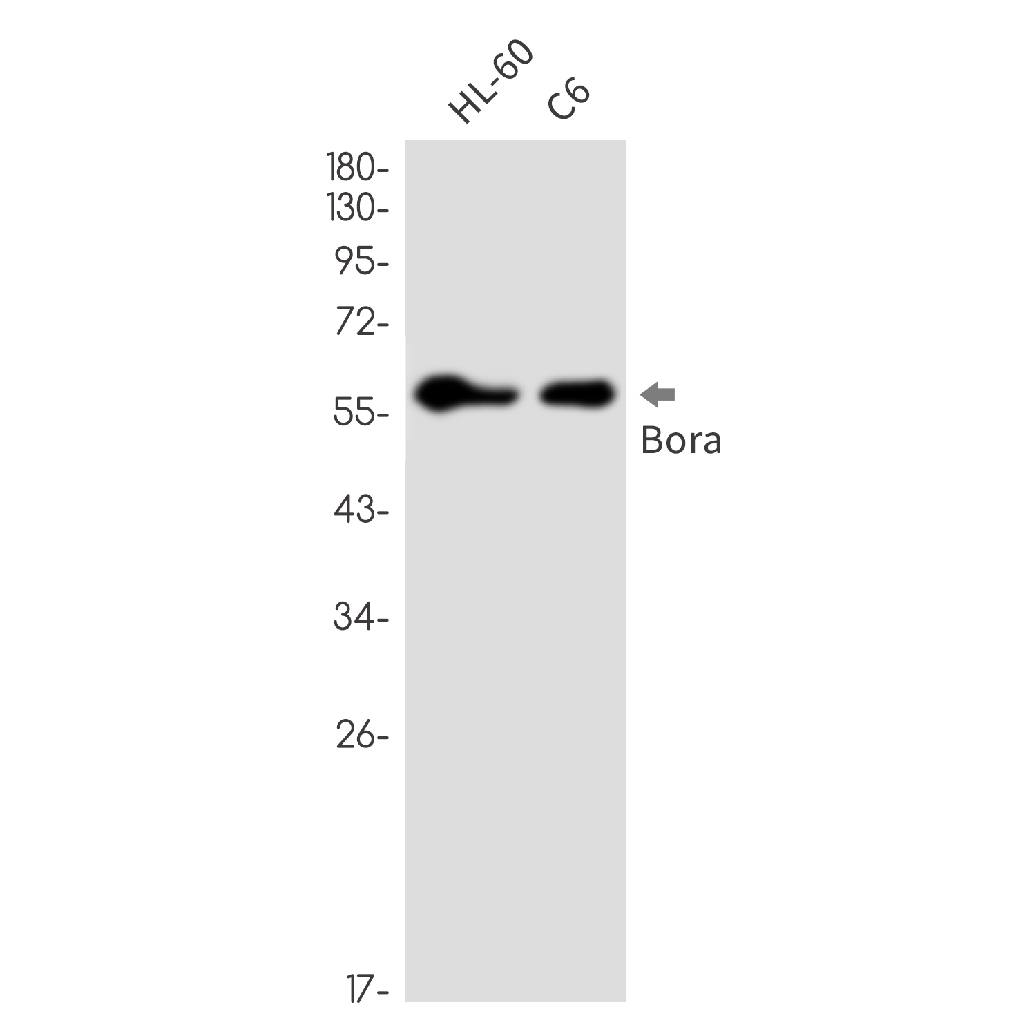 Caldesmon/CDM Rabbit mAb ABZ3267