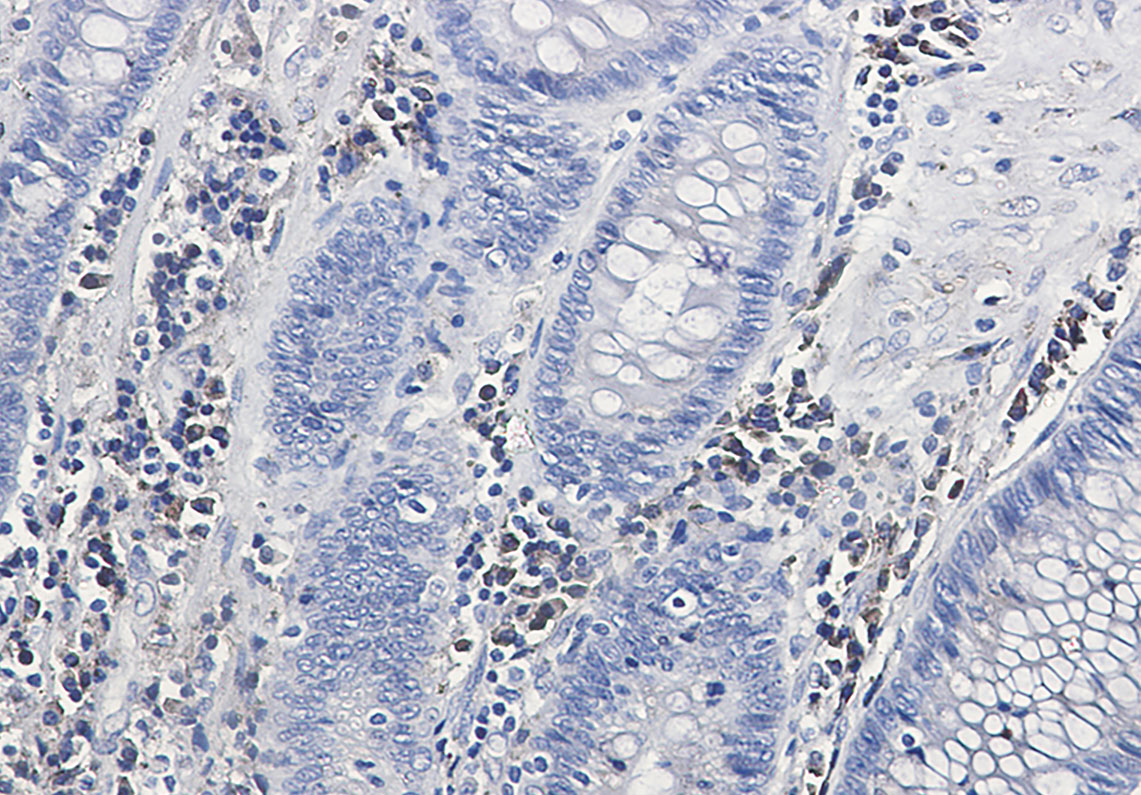 Calumenin Rabbit mAb ABZ3268