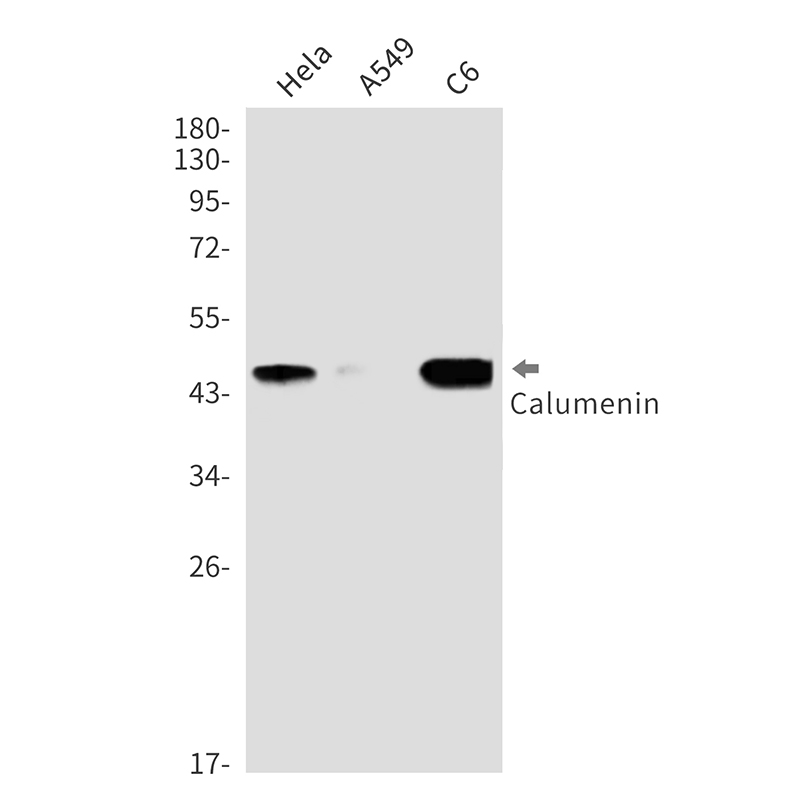 Calumenin Rabbit mAb ABZ3268
