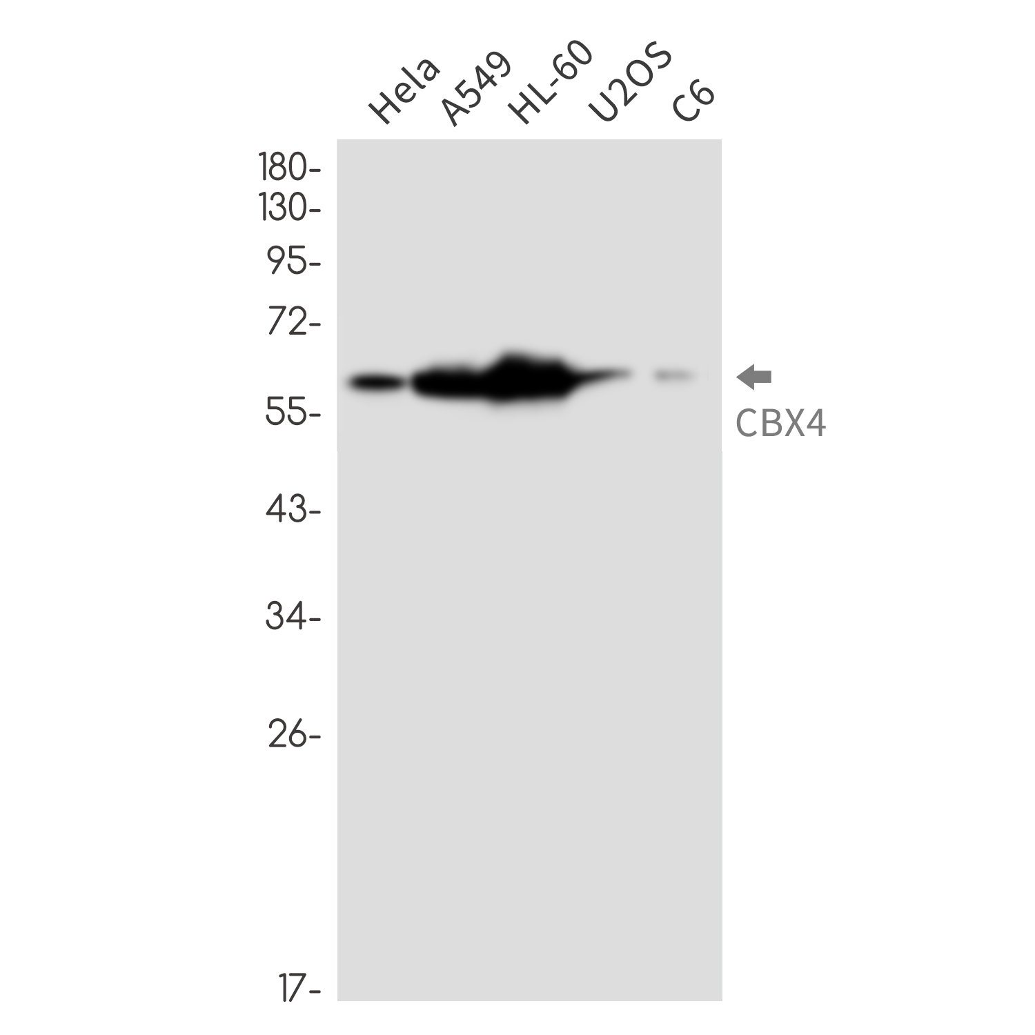 CBX4 Rabbit mAb ABZ3270