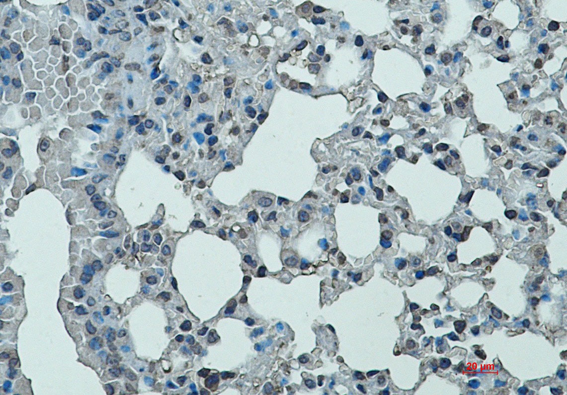 CD11a Rabbit mAb ABZ3271