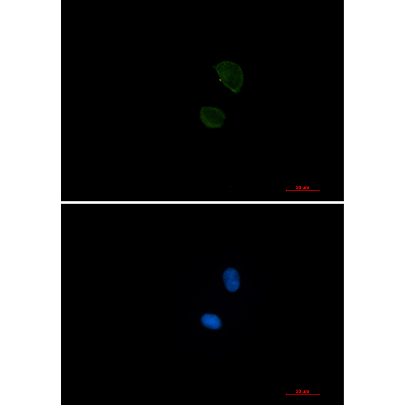 CD99 Rabbit mAb ABZ3273