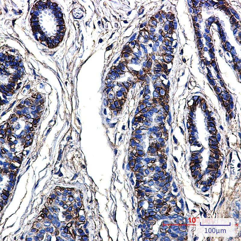 CD99 Rabbit mAb ABZ3273