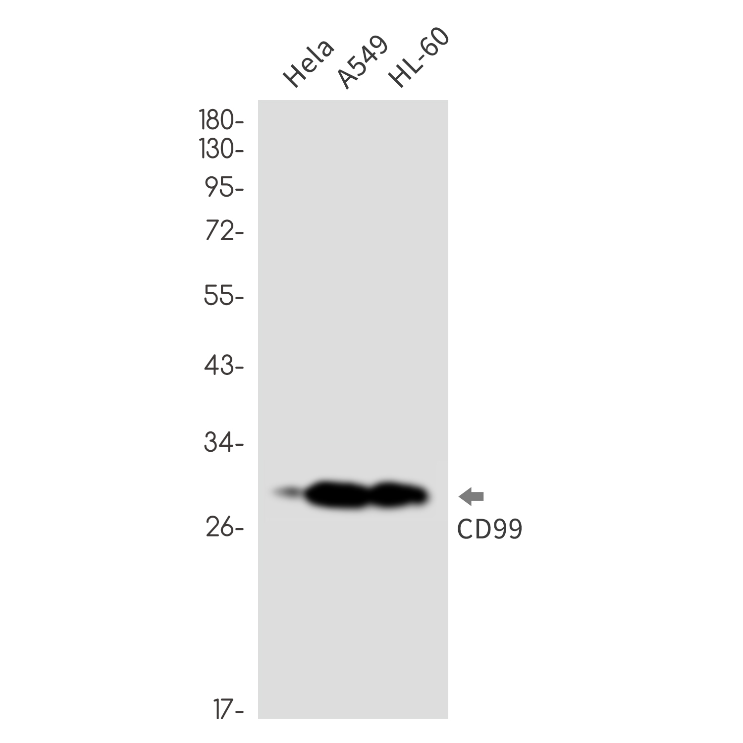 CD99 Rabbit mAb ABZ3273
