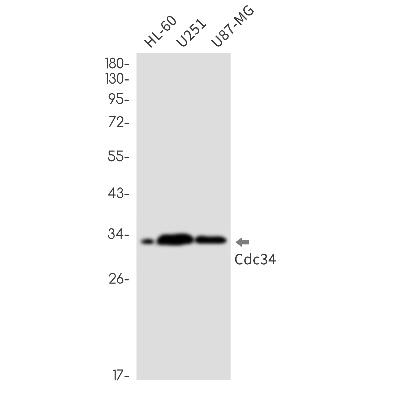 CDC34 Rabbit mAb ABZ3274