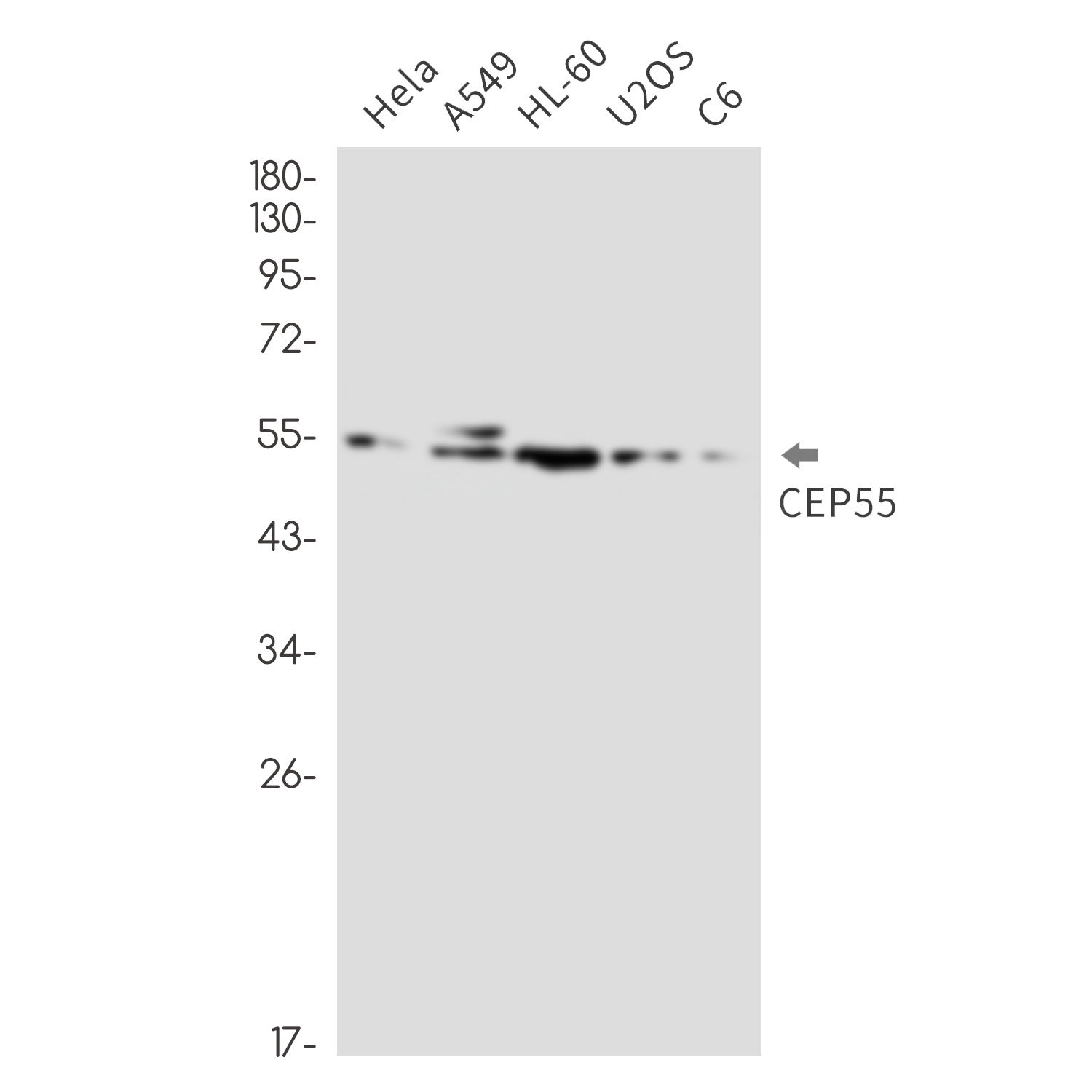CEP55 Rabbit mAb ABZ3275