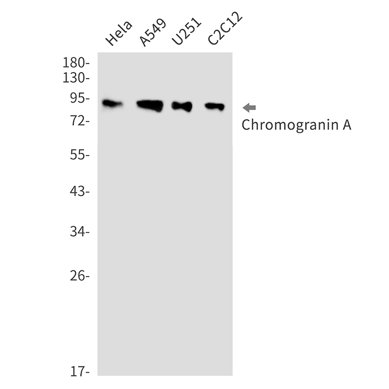 Chromogranin A Rabbit mAb ABZ3276