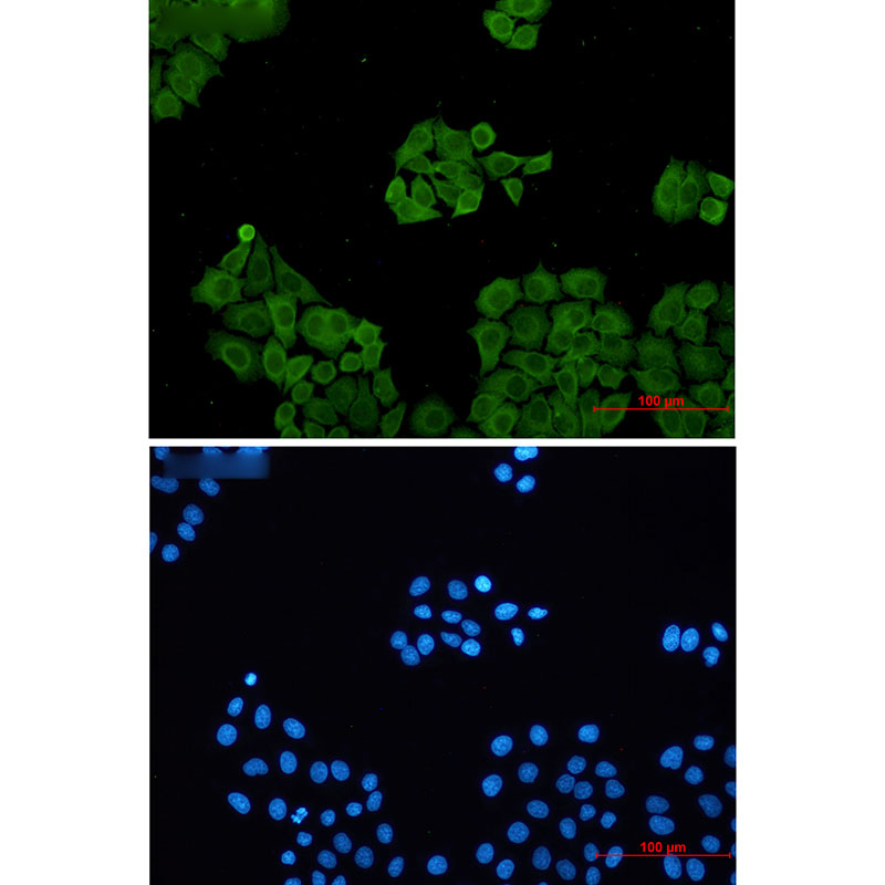 CLIC1 Rabbit mAb ABZ3277