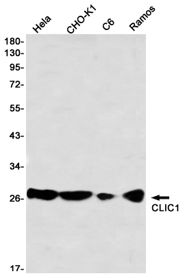 CLIC1 Rabbit mAb ABZ3277