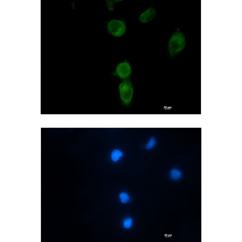 CLPX Rabbit mAb ABZ3278