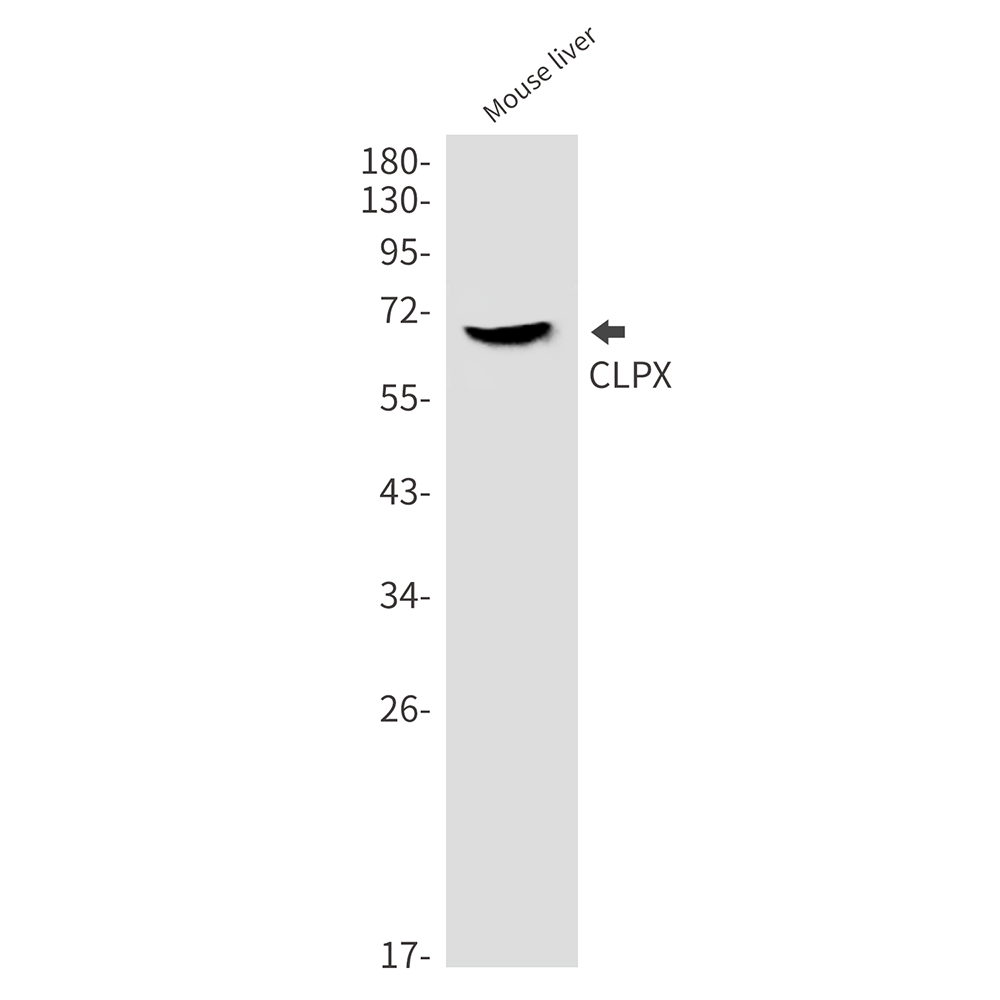 CLPX Rabbit mAb ABZ3278