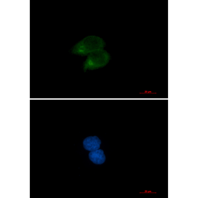 CLSTN1 Rabbit mAb ABZ3279