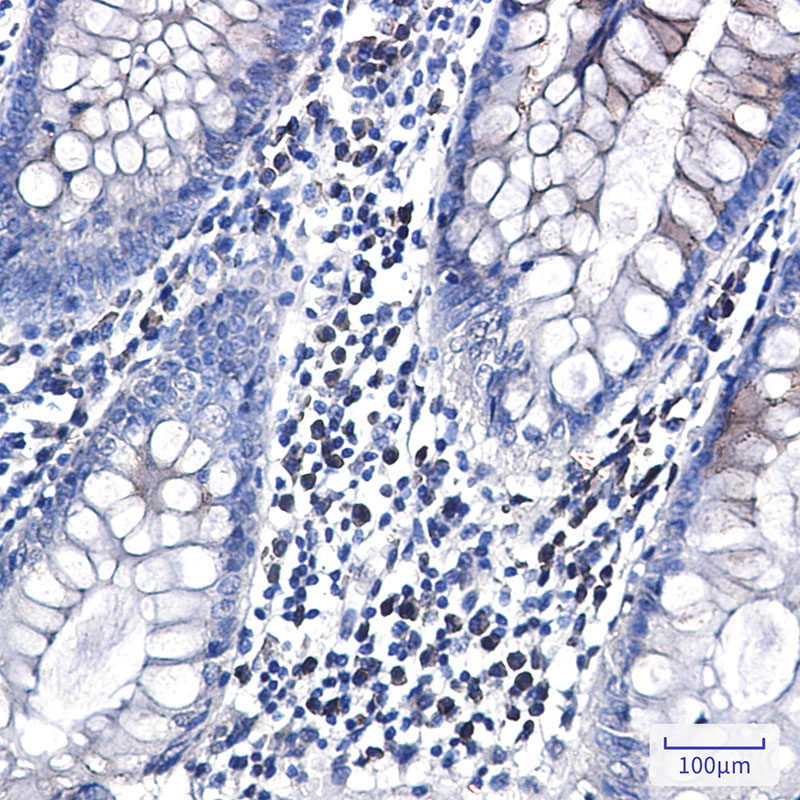 CLSTN1 Rabbit mAb ABZ3279