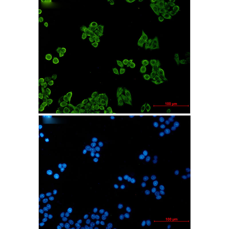 CSDE1/NRU Rabbit mAb ABZ3280