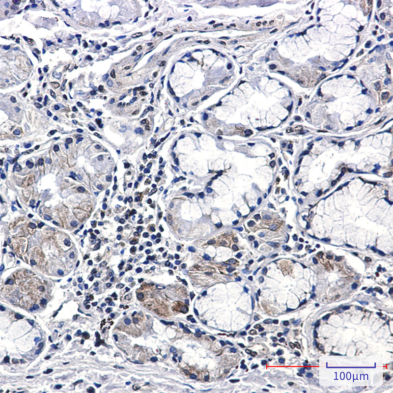 CSDE1/NRU Rabbit mAb ABZ3280