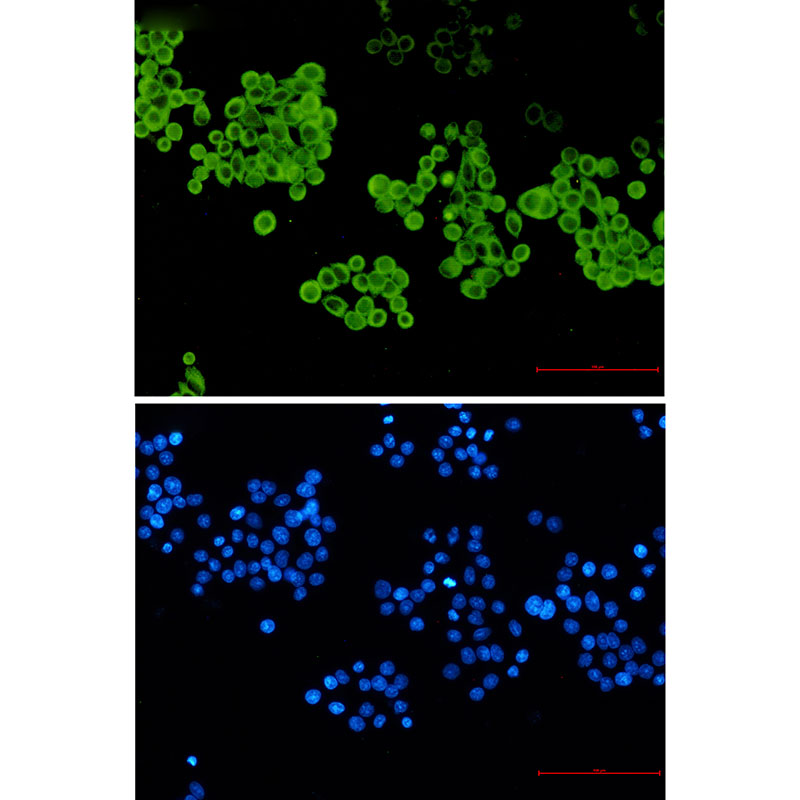 Cytochrome P450 2D6 Rabbit mAb ABZ3281