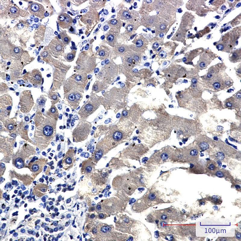 Cytochrome P450 2D6 Rabbit mAb ABZ3281