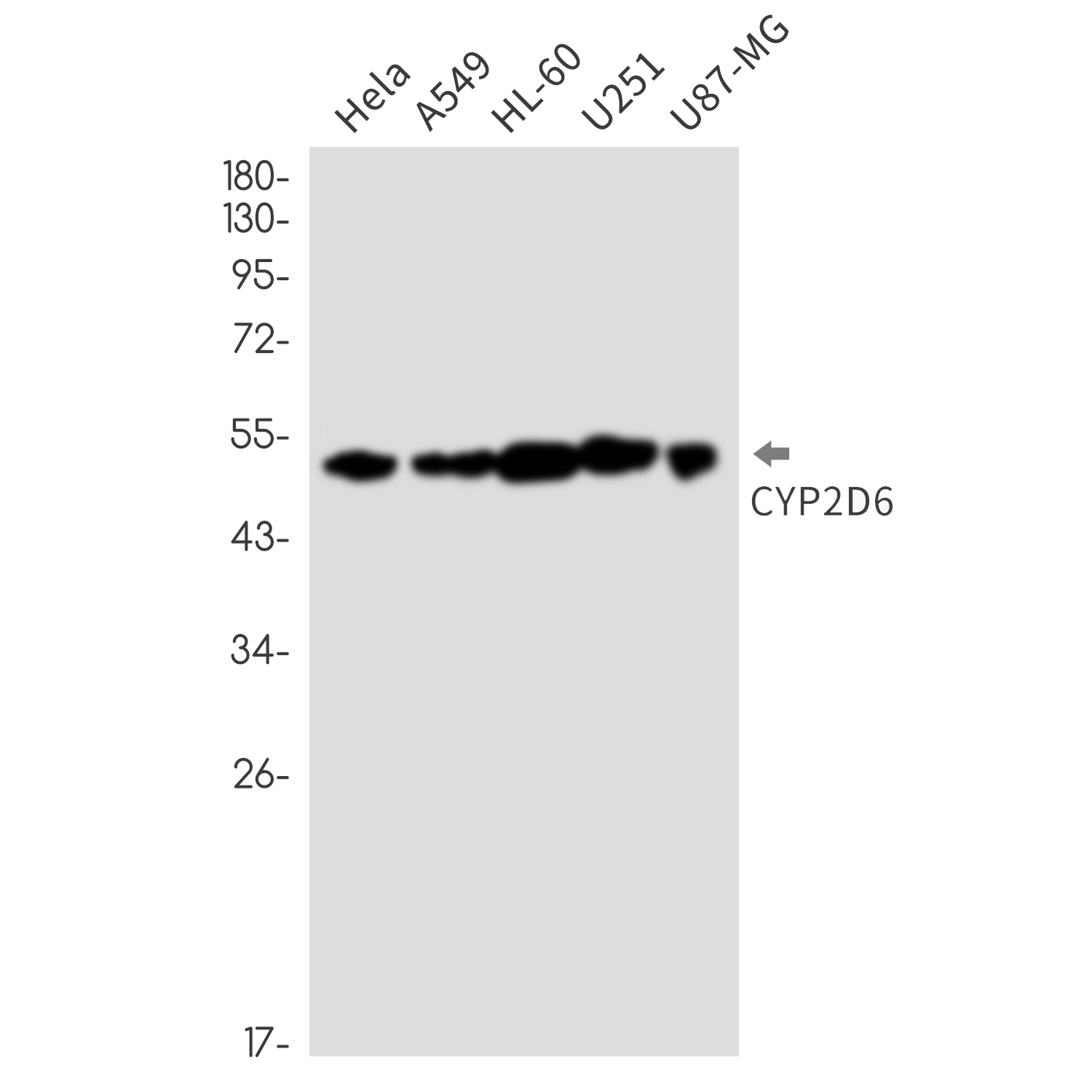 Cytochrome P450 2D6 Rabbit mAb ABZ3281