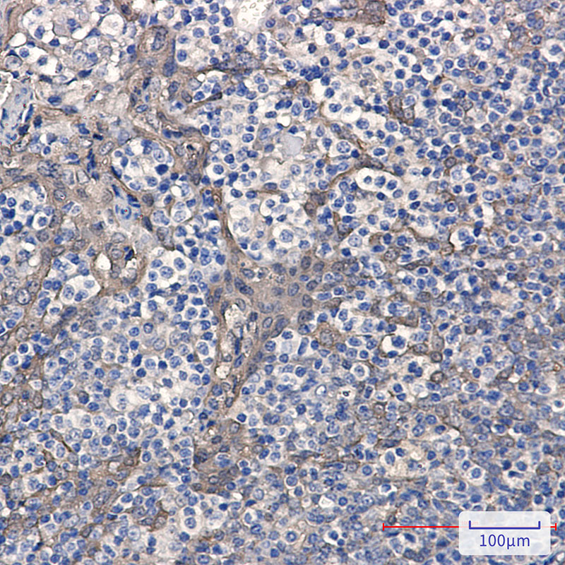 Cystatin B Rabbit mAb ABZ3282