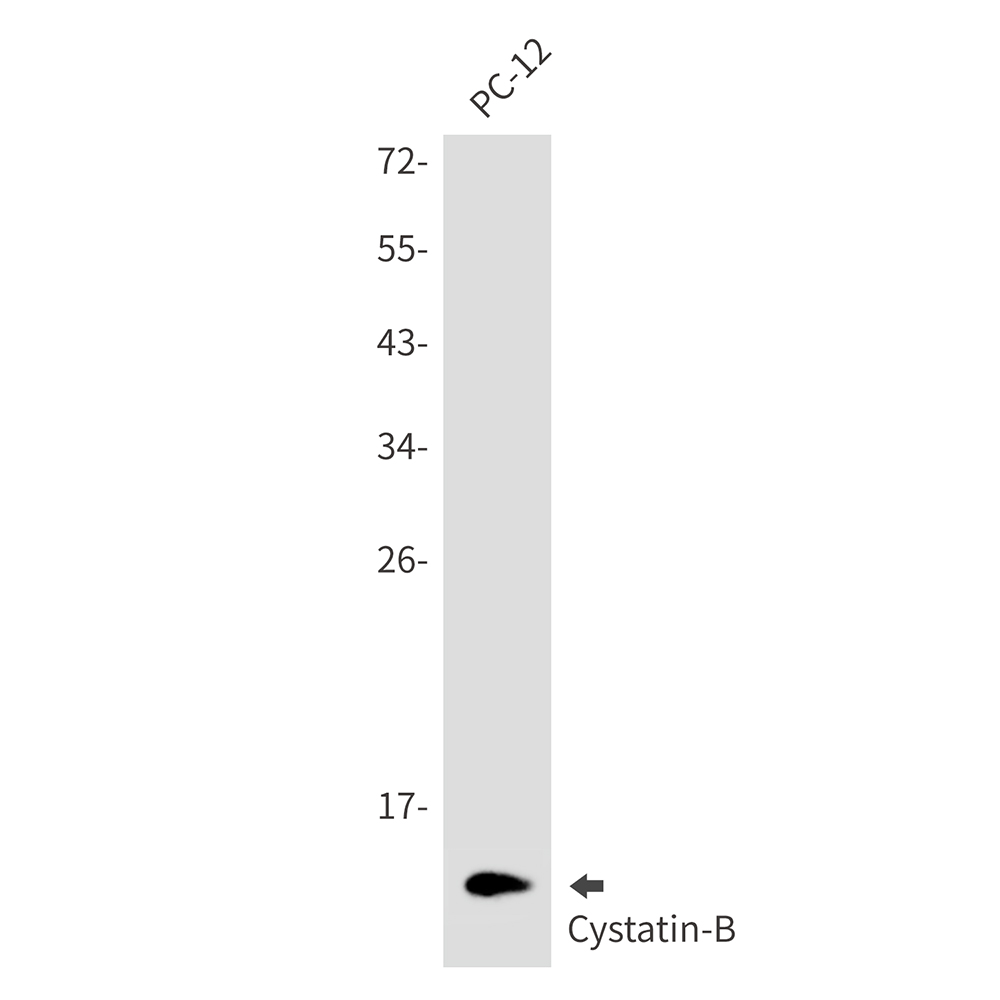 Cystatin B Rabbit mAb ABZ3282