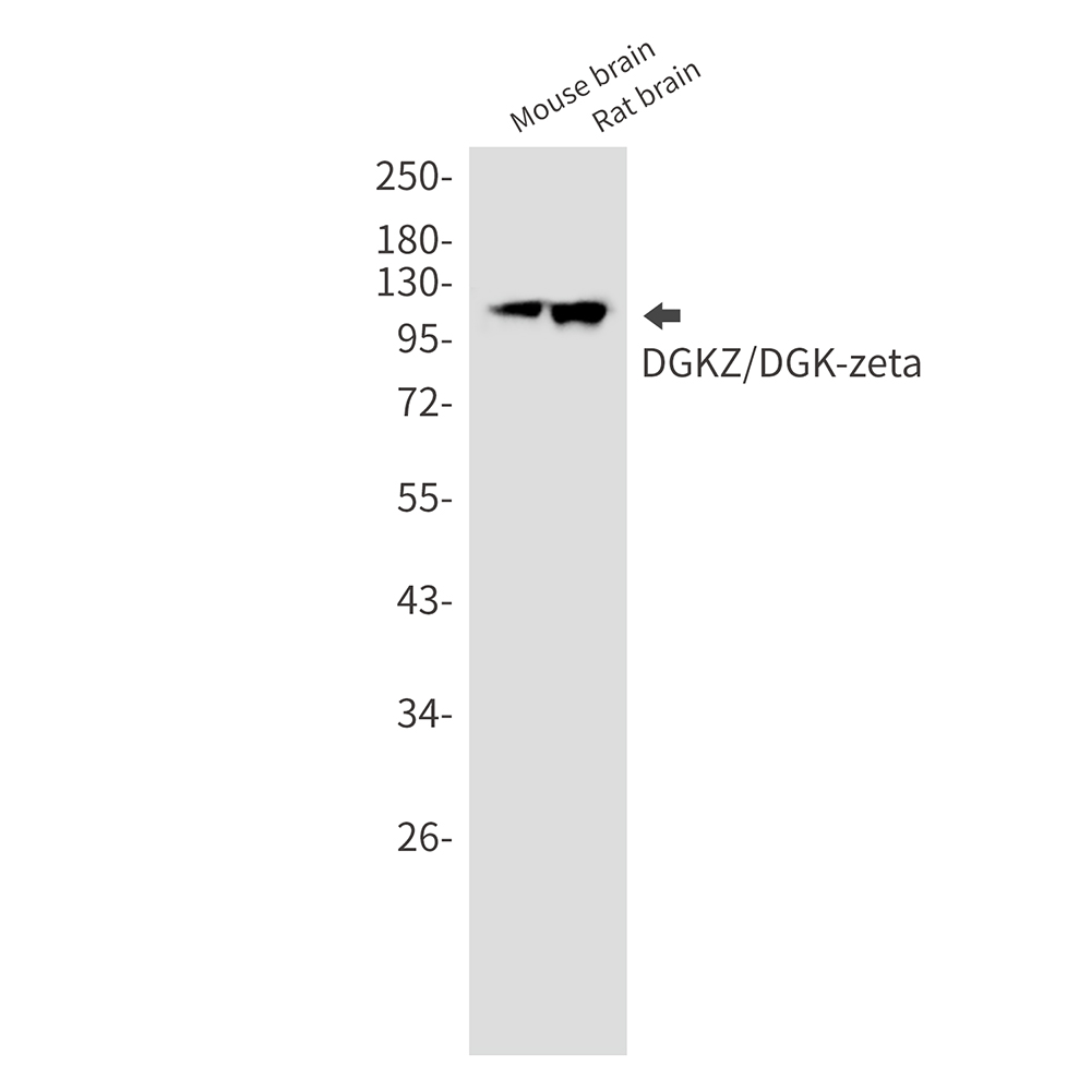 DGKZ/DGK-zeta Rabbit mAb ABZ3284
