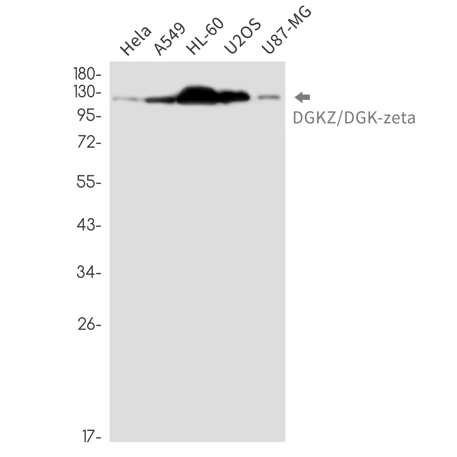 DGKZ/DGK-zeta Rabbit mAb ABZ3284
