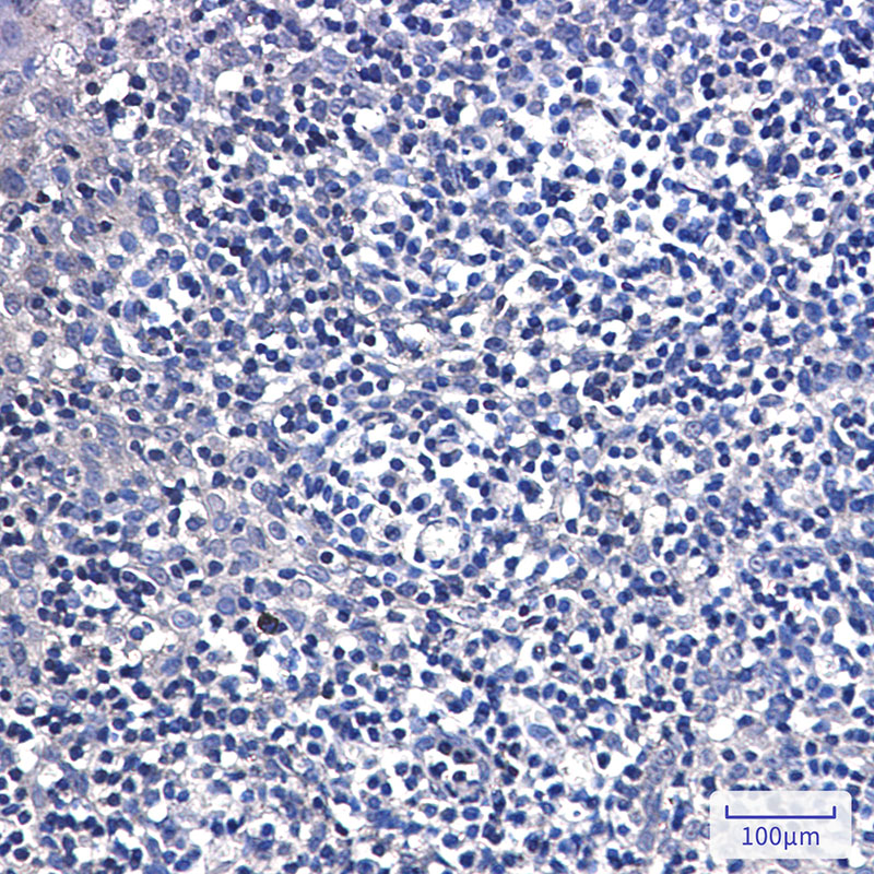 DTYMK Rabbit mAb ABZ3286