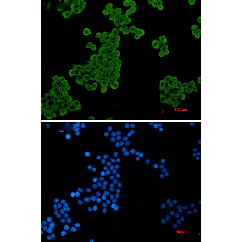EEF2/Elongation factor 2 Rabbit mAb ABZ3288