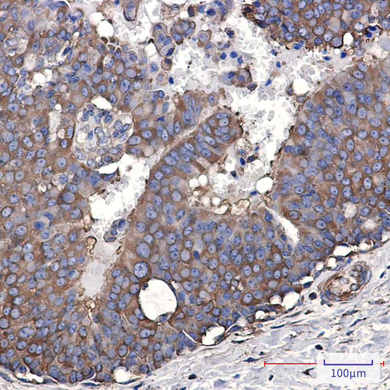 EEF2/Elongation factor 2 Rabbit mAb ABZ3288