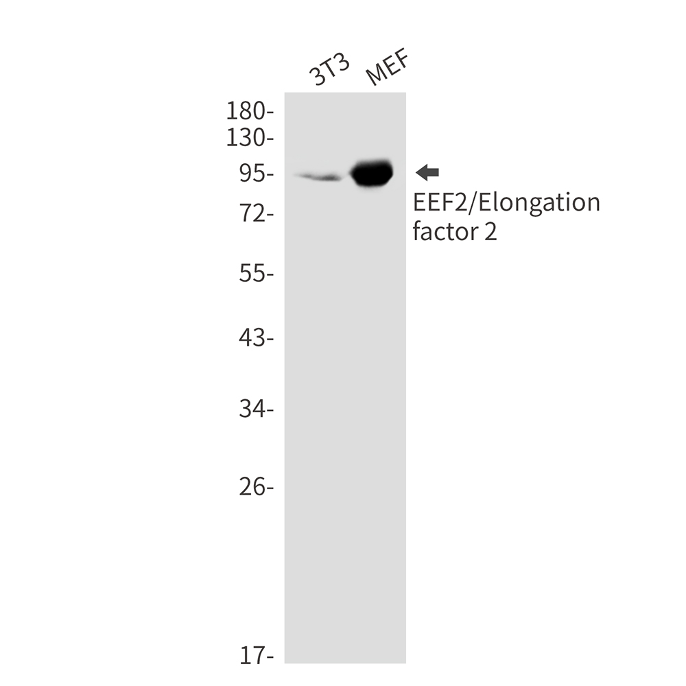 EEF2/Elongation factor 2 Rabbit mAb ABZ3288