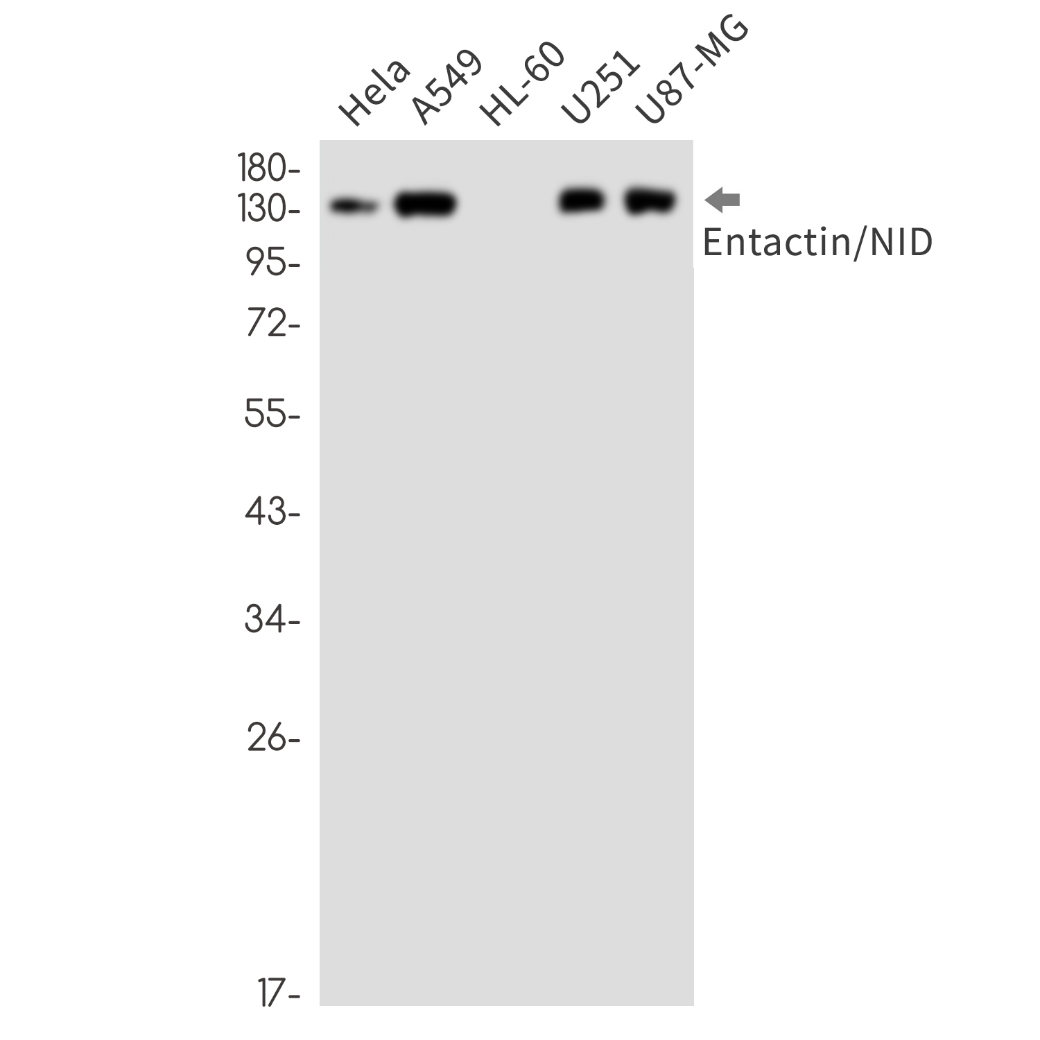 Entactin Rabbit mAb ABZ3290