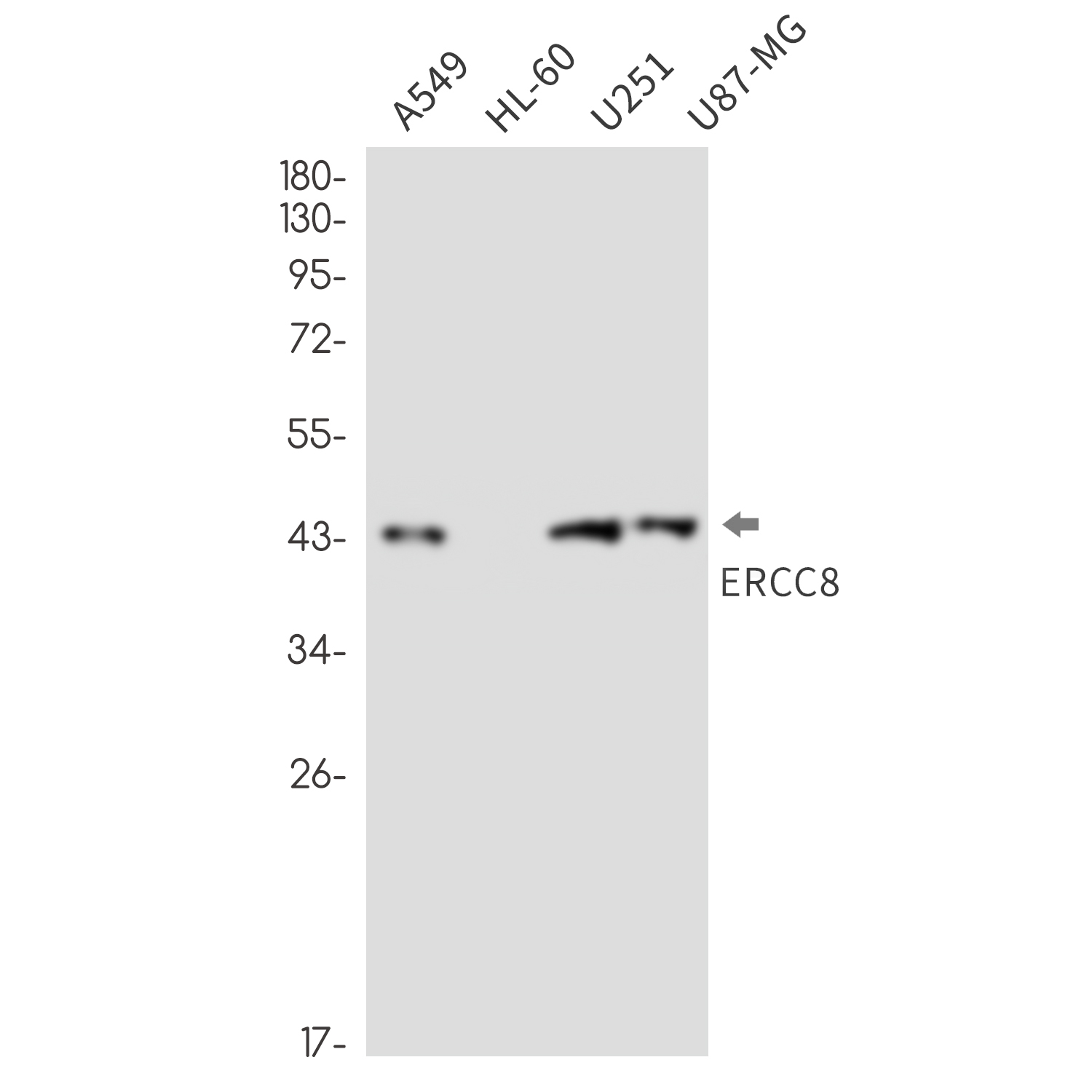 ERCC8 Rabbit mAb ABZ3292