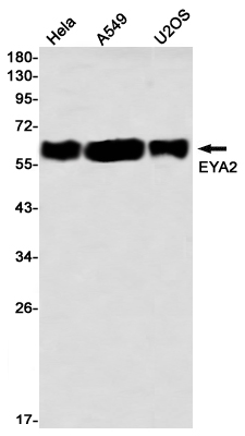 EYA2 Rabbit mAb ABZ3293