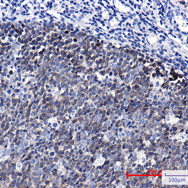 Ezrin Rabbit mAb ABZ3294