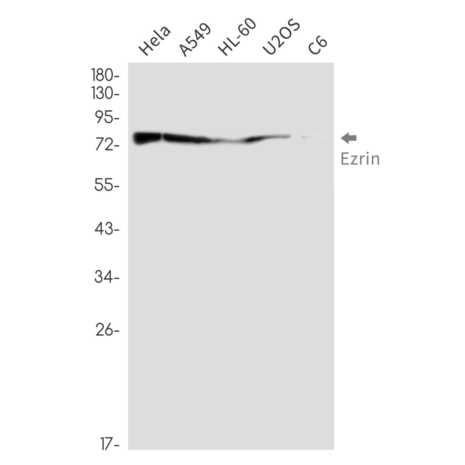 Ezrin Rabbit mAb ABZ3294