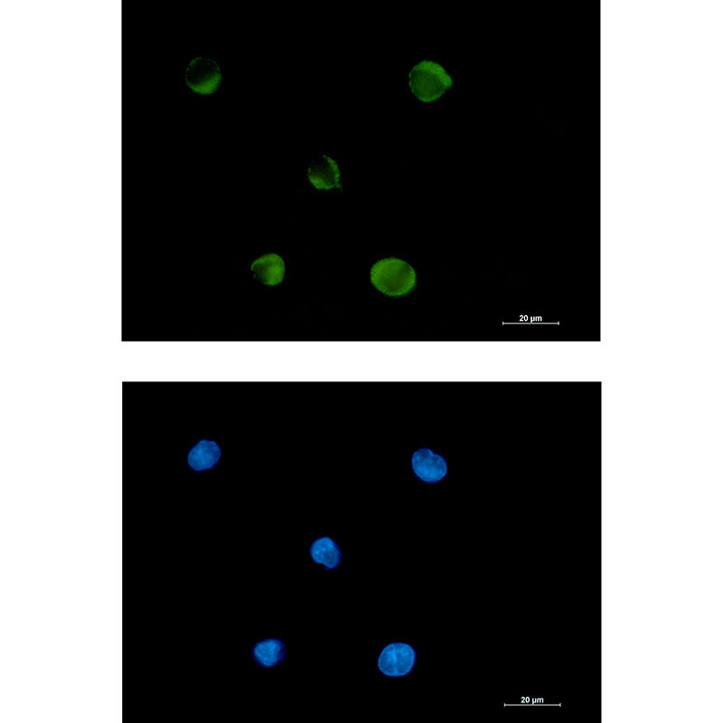 FADS1 Rabbit mAb ABZ3295