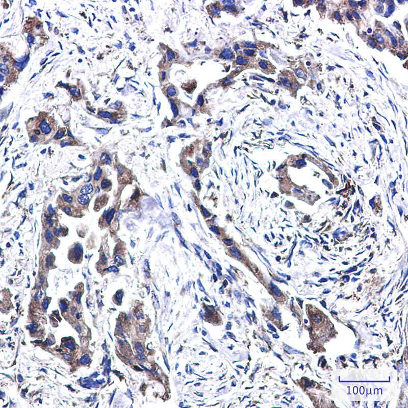 FADS1 Rabbit mAb ABZ3295