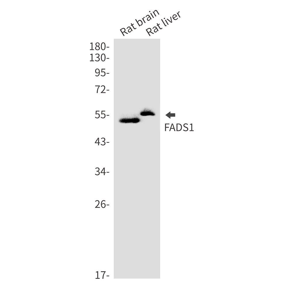 FADS1 Rabbit mAb ABZ3295
