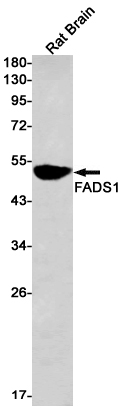 FADS1 Rabbit mAb ABZ3295