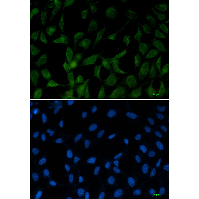 FE65 Rabbit mAb ABZ3296