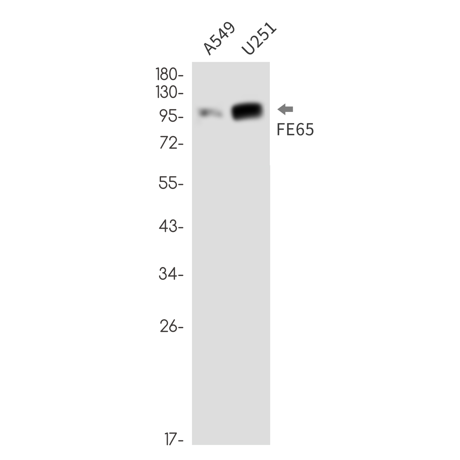 FE65 Rabbit mAb ABZ3296
