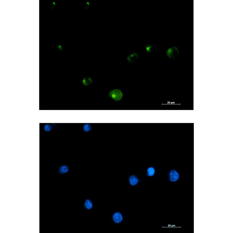 FGFR1 Oncogene Partner Rabbit mAb ABZ3297