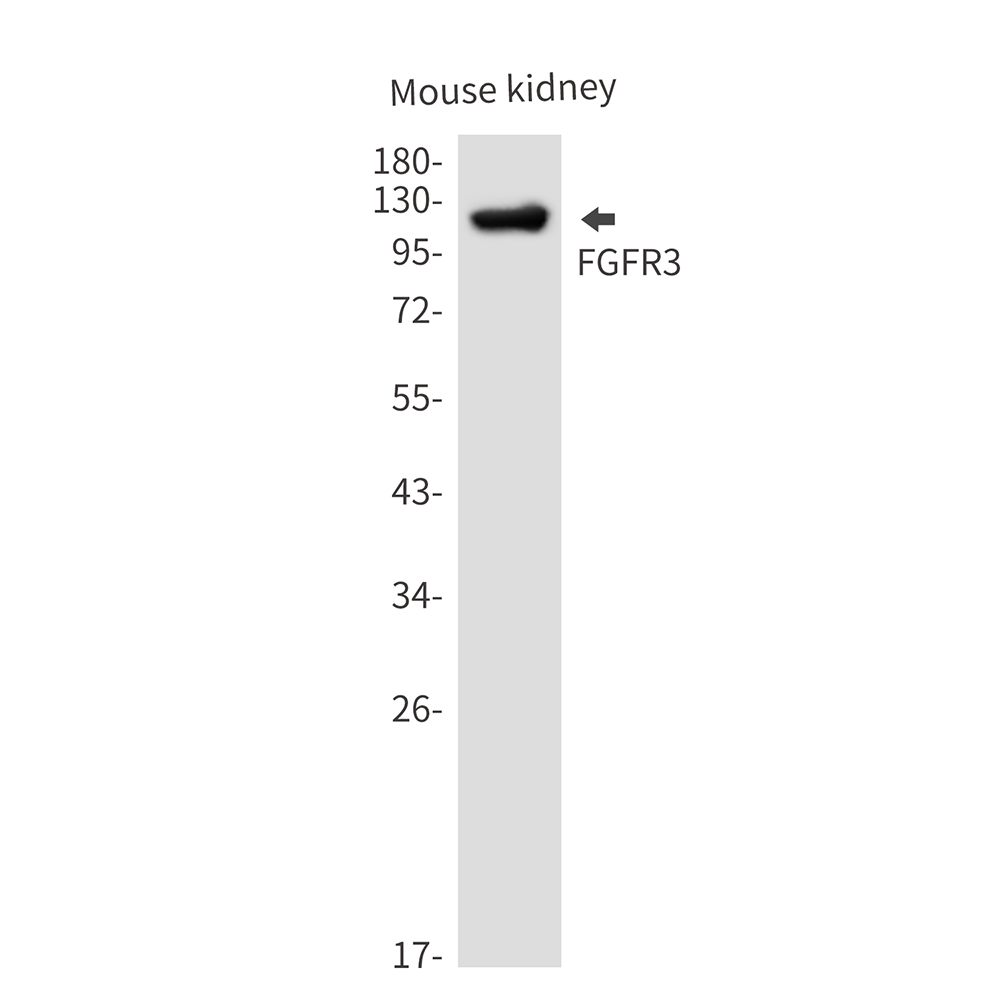 FGFR3 Rabbit mAb ABZ3298