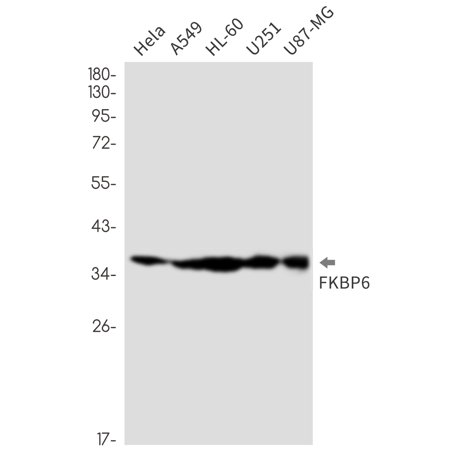 FKBP6 Rabbit mAb ABZ3299